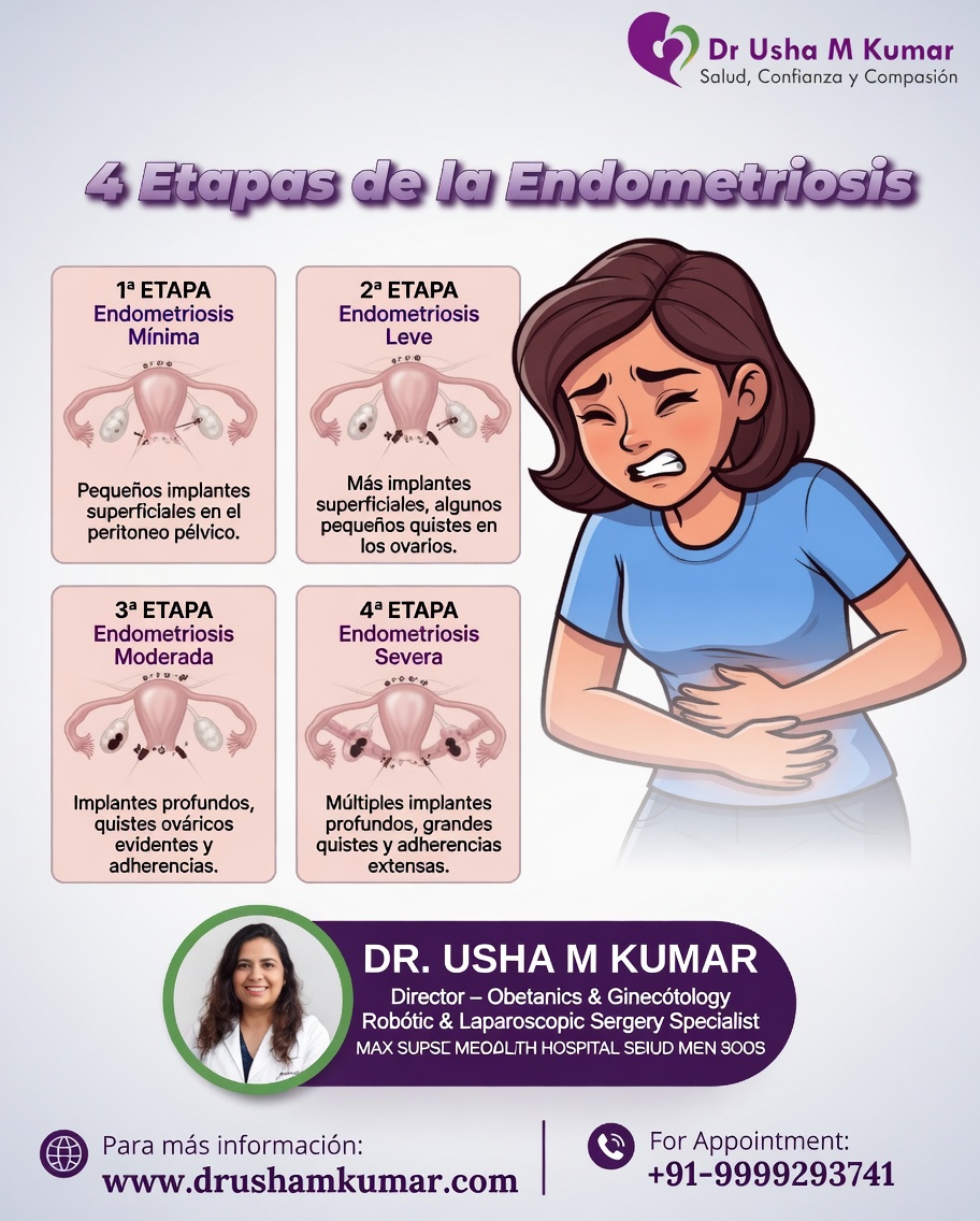Lo que toda mujer debe saber sobre la endometriosis