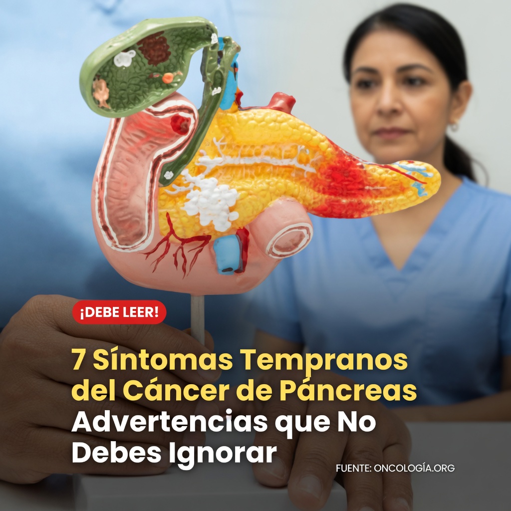 Cómo identificar las señales de alerta y los síntomas del cáncer de páncreas que todos deberían conocer