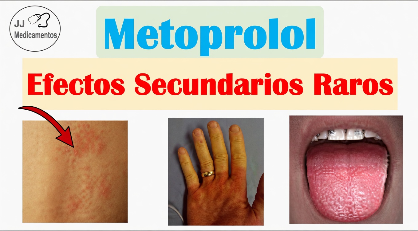 ¿Cuáles son los 10 efectos secundarios comunes del metoprolol y cómo puede detectarlos a tiempo?