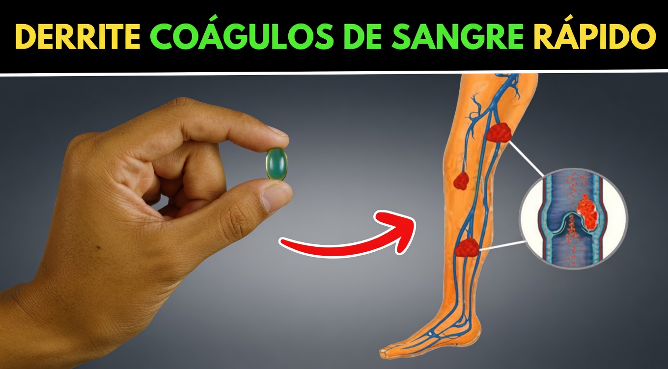 1 vitamina al día para disolver los coágulos de sangre en las piernas: el consejo de un cardiólogo