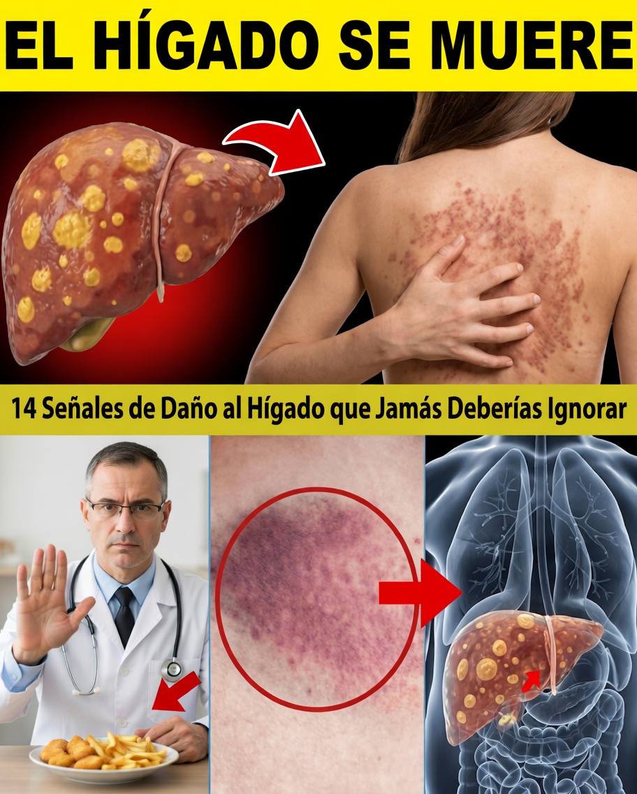 11 signos extraños de daño hepático que no debes ignorar