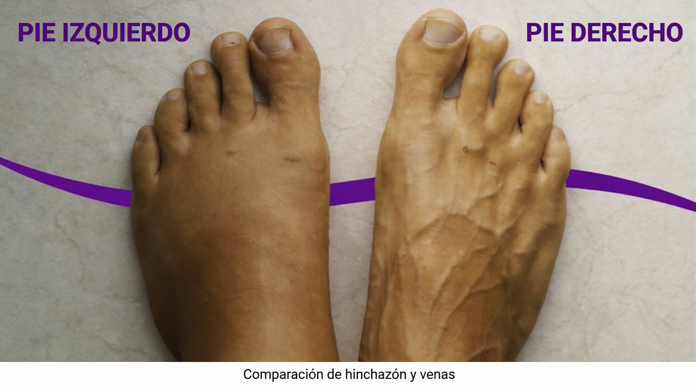 ¿Podría un dolor “inofensivo” en la pierna ser una señal de advertencia que no deberías ignorar?