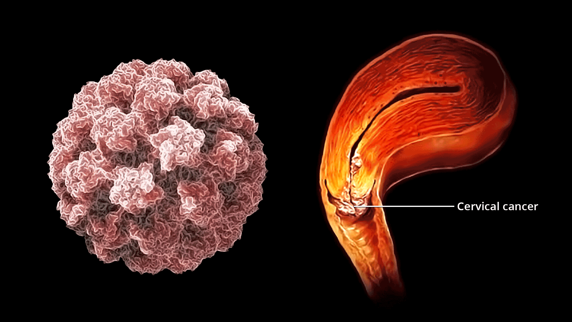 Los síntomas críticos del cáncer de cuello uterino que toda mujer necesita conocer y nunca ignorar