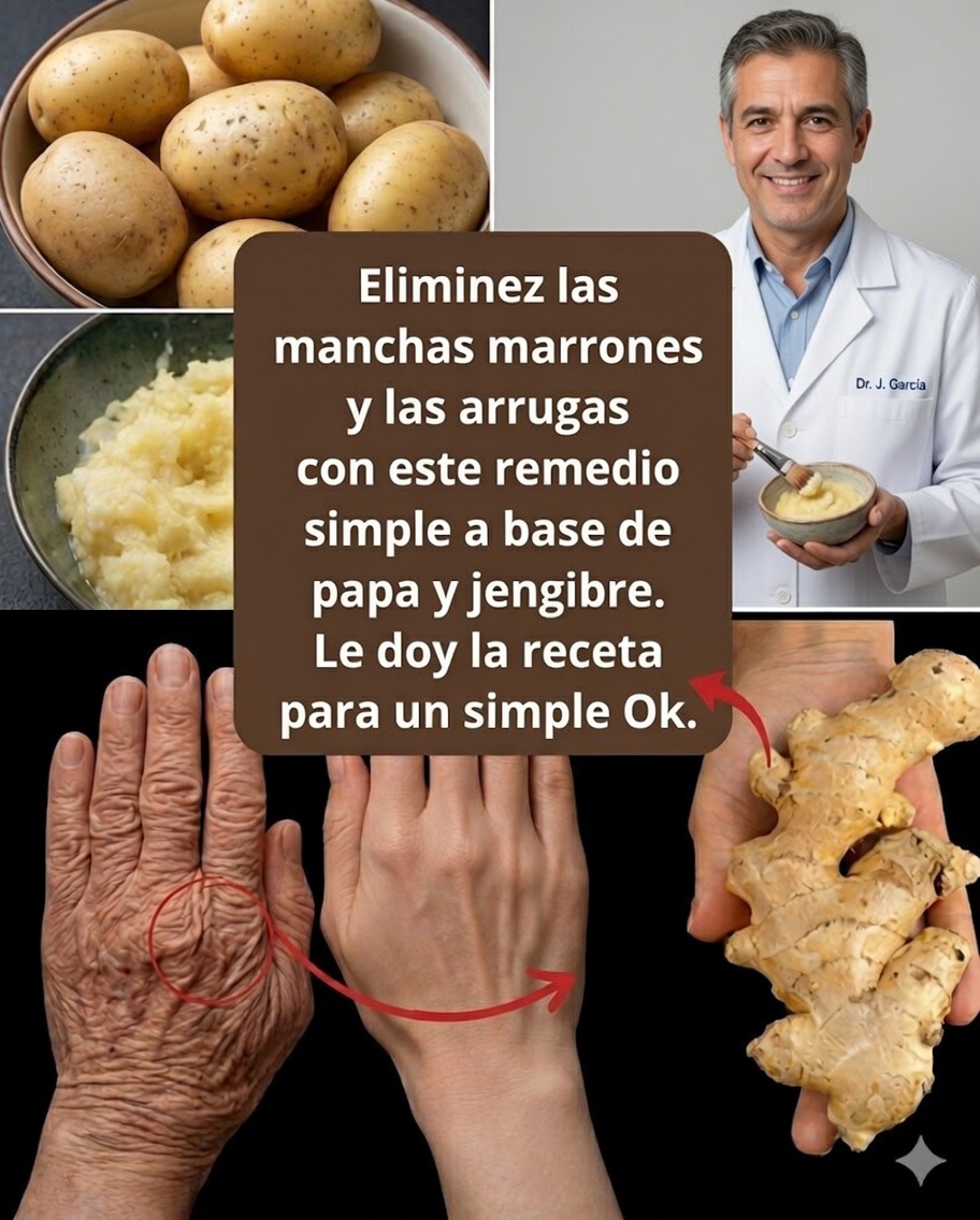 Elimina naturalmente las manchas oscuras y las arrugas: remedios caseros para una piel más joven