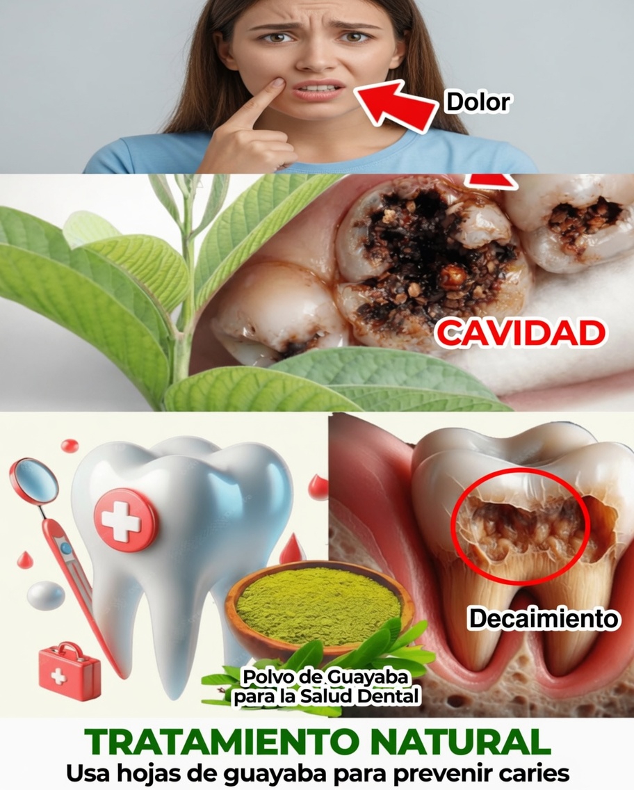 Las 3 mejores maneras de tratar la caries dental con hojas de guayaba: simples y económicas