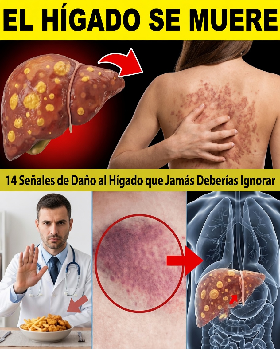 11 signos extraños de daño hepático que no debes ignorar