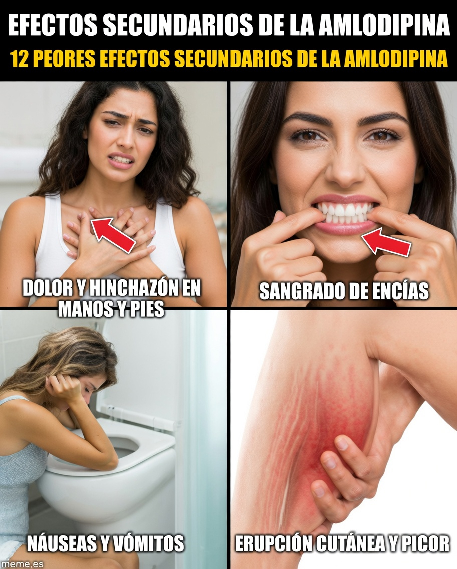 ¿Cuáles son los efectos secundarios más comunes de la amlodipina? 12 cosas a las que debe prestar atención