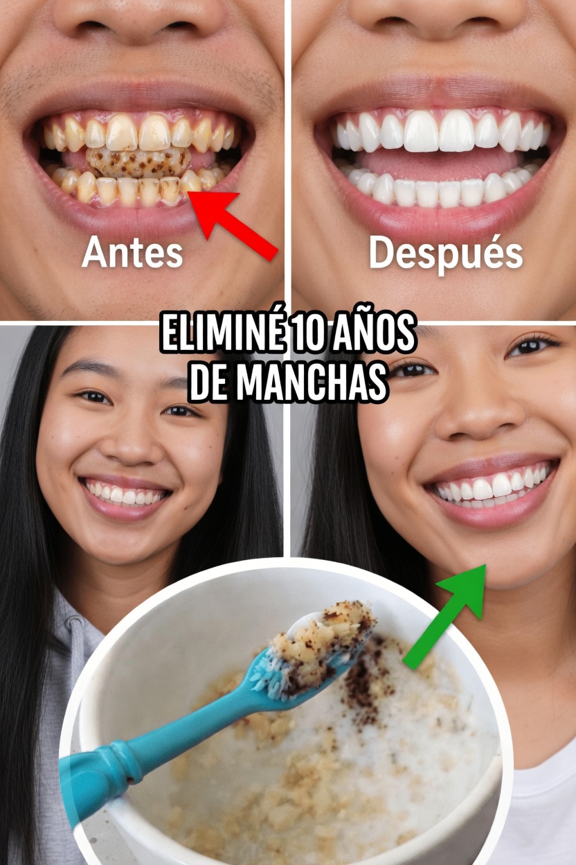 Por qué aparecen las manchas superficiales y por qué es importante un pulido suave