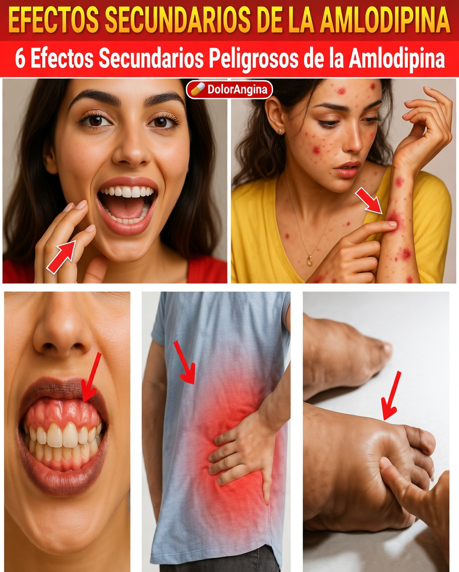 ¿Cuáles son los efectos secundarios más comunes de la amlodipina y cómo puede manejarlos?