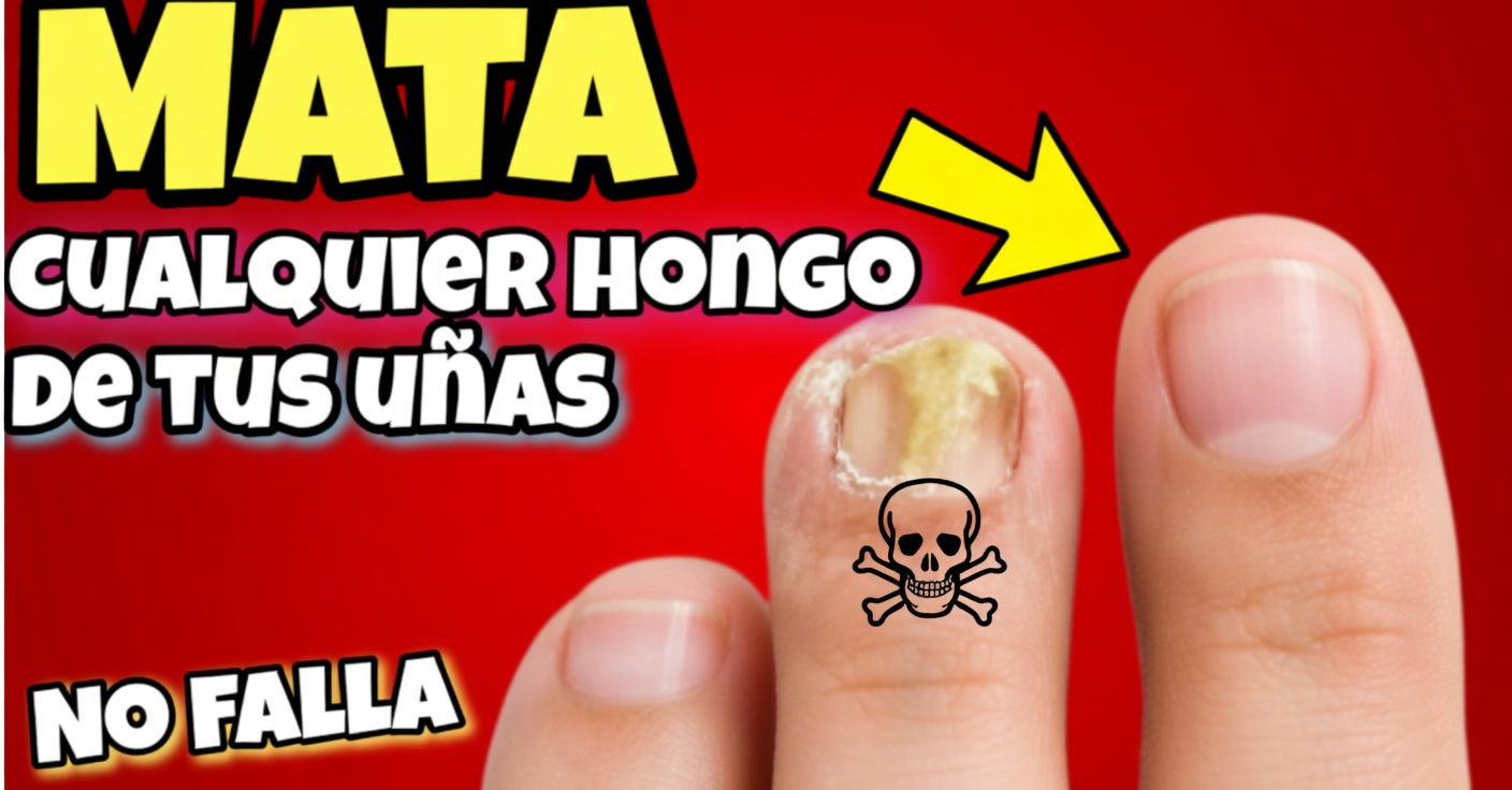Vinagre para los hongos en las uñas