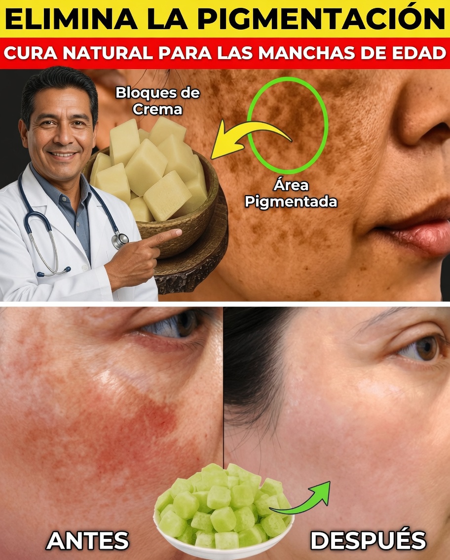 Elimina la pigmentación, el melasma y las manchas oscuras de forma natural en 20 días: un ritual suave para una piel radiante