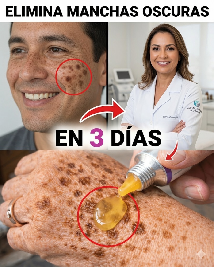 Elimina las manchas de la edad de forma natural: mascarilla sencilla de maicena, bicarbonato y limón para una piel más clara y uniforme