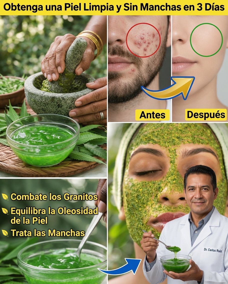 Cómo hacer y usar un gel casero de neem para una piel más saludable en casa