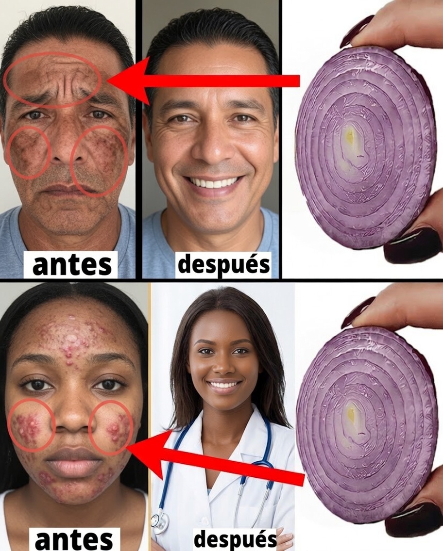 Mezcla maicena con cebolla para una piel blanca como la nieve y transparente como el cristal: un secreto natural que desearías haber conocido antes