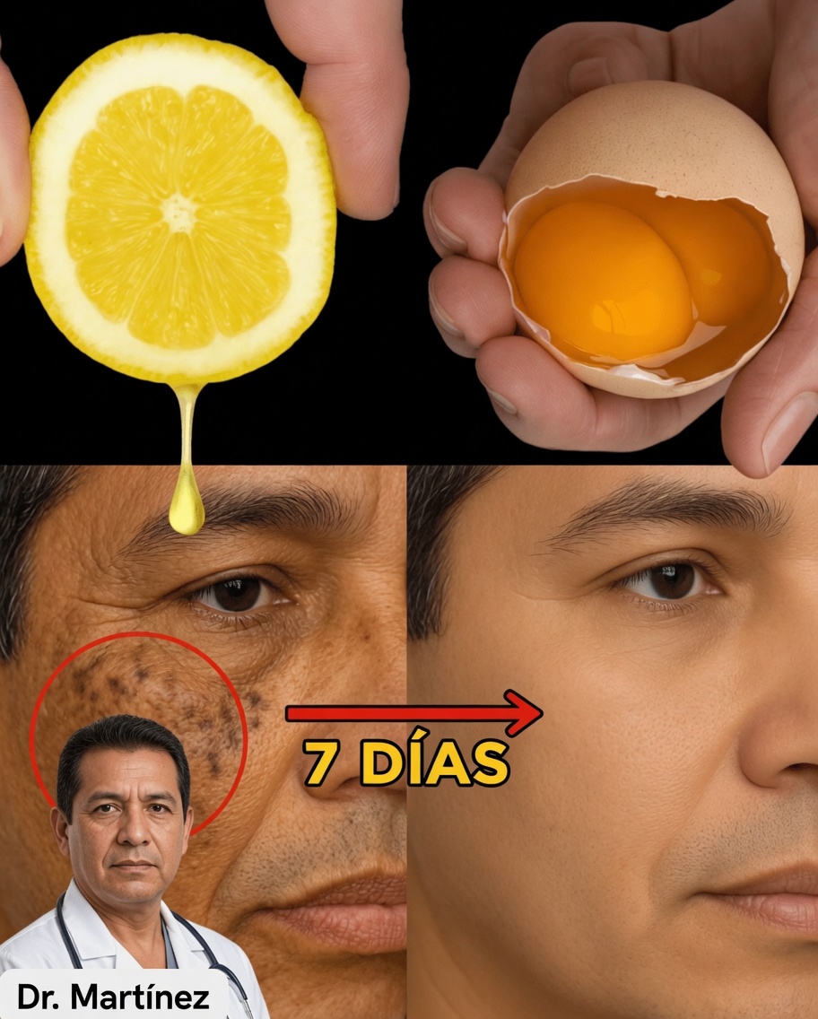 Mezcla de Limón y Huevo para una Piel Naturalmente Joven