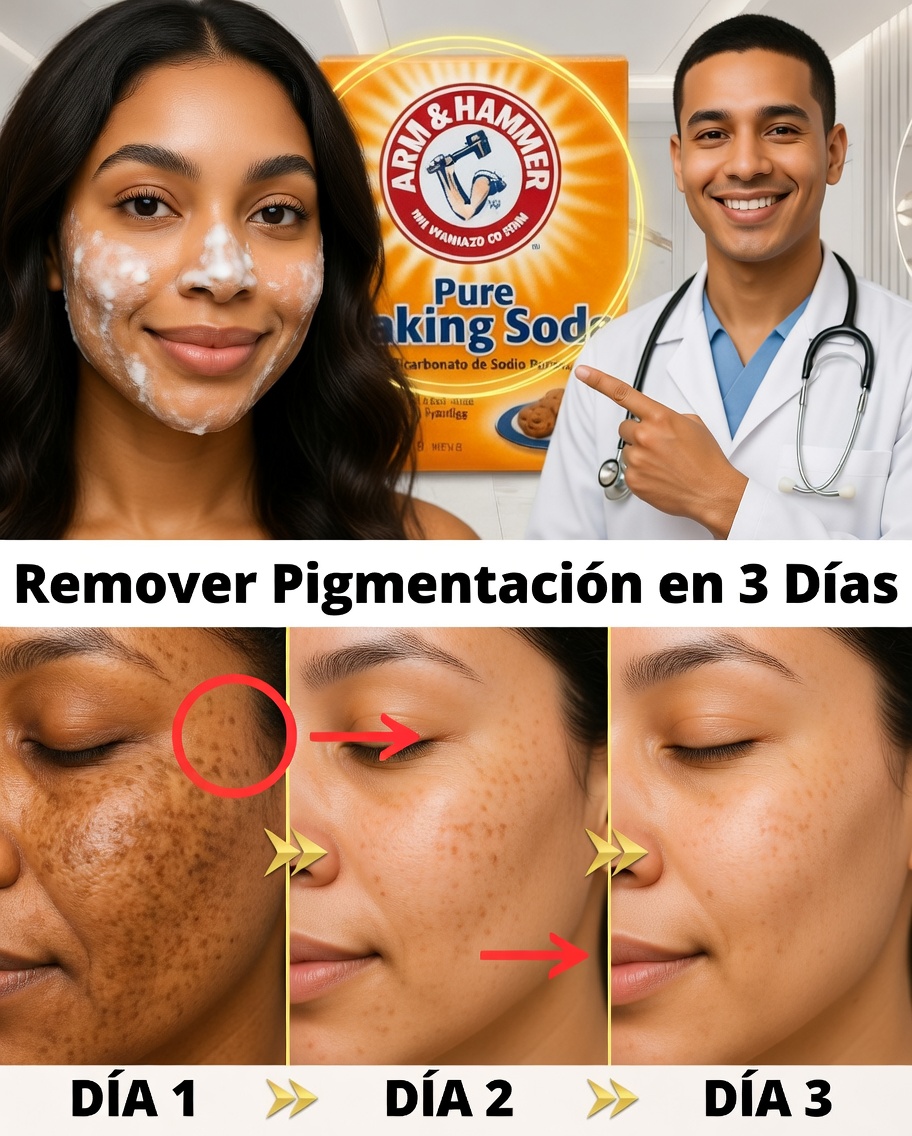 Crema casera de bicarbonato: di adiós a las arrugas y manchas oscuras