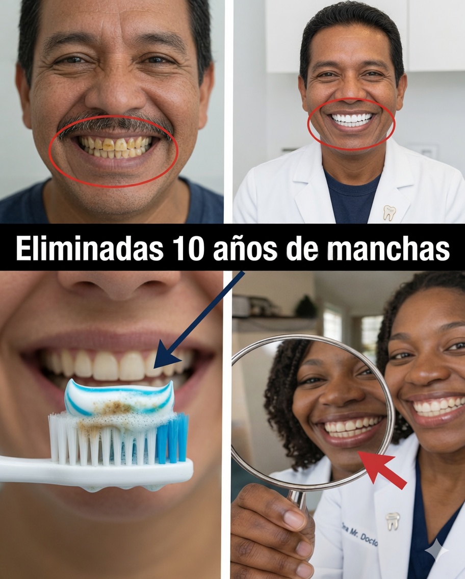 ¿En 2 Minutos Elimina 10 Años de Manchas de los Dientes? La Verdad que te Va a Sorprender