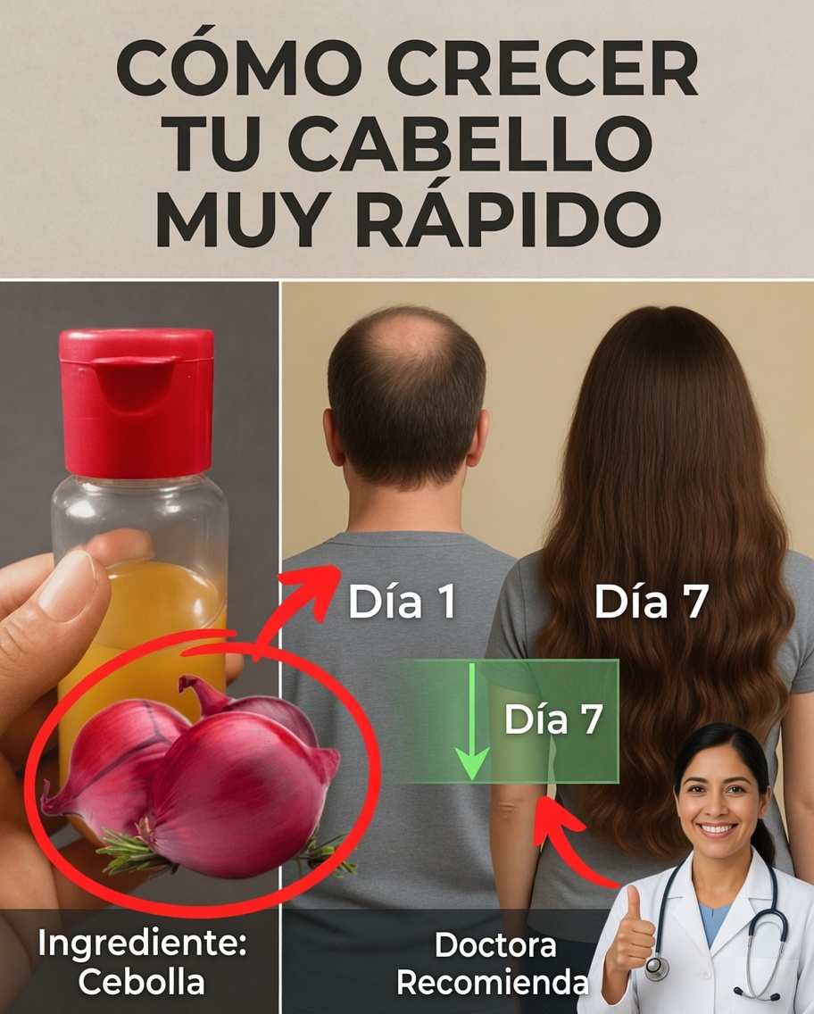 Cómo hacer aceite de cebolla para el crecimiento rápido del cabello y detener la caída