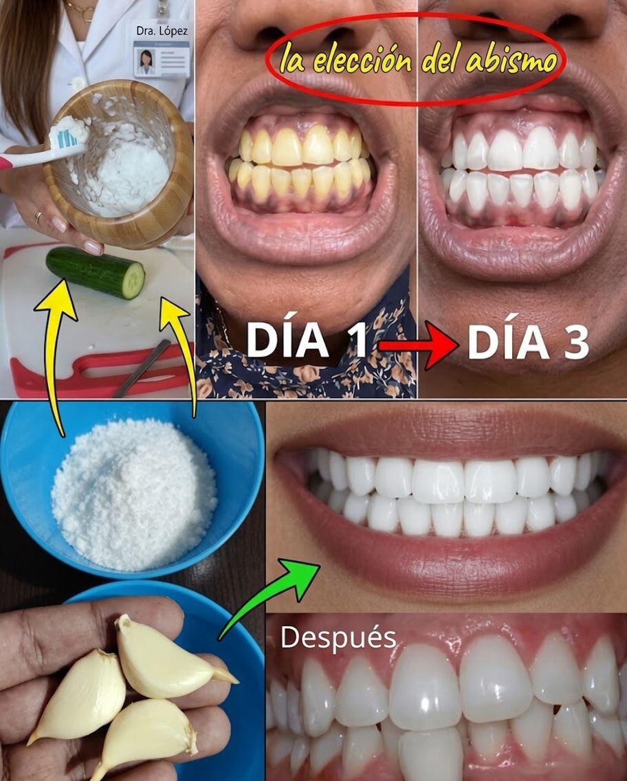 Sonríe como nunca: descubre los secretos para una sonrisa deslumbrante en casa