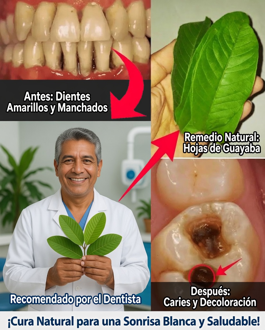 3 Maneras Simples y Económicas de Tratar la Caries Dental con Hojas de Guayaba