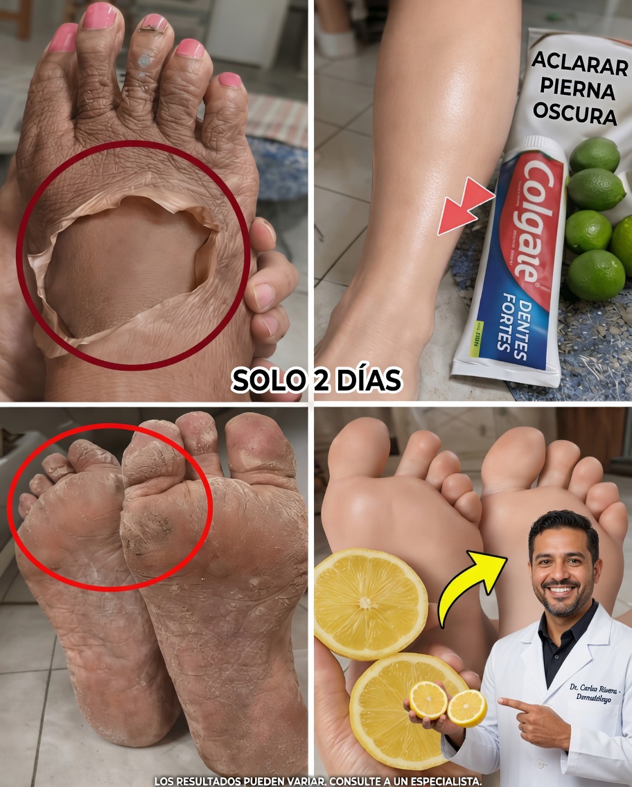 Hábitos diarios sencillos que mejoraron la apariencia de mis piernas para una piel más suave, luminosa y saludable