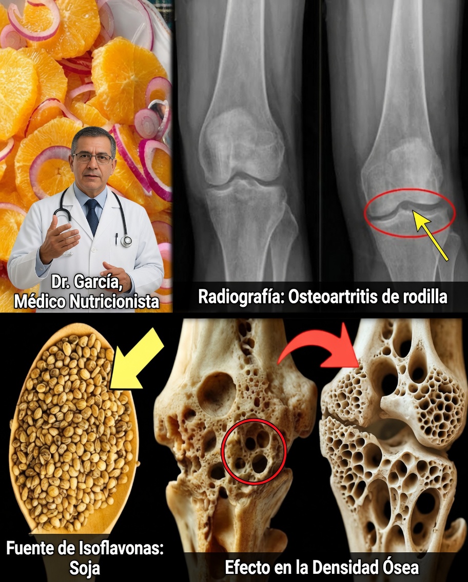 Advertencia sobre la osteoporosis: el único alimento natural que puede ayudar a fortalecer los huesos débiles