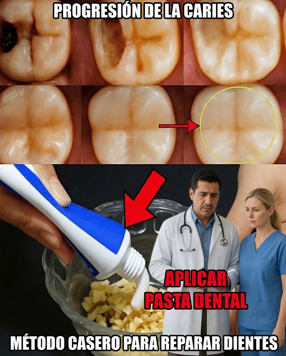 Lo que los dentistas rara vez cuentan: consejos naturales que pueden ayudar a prevenir caries