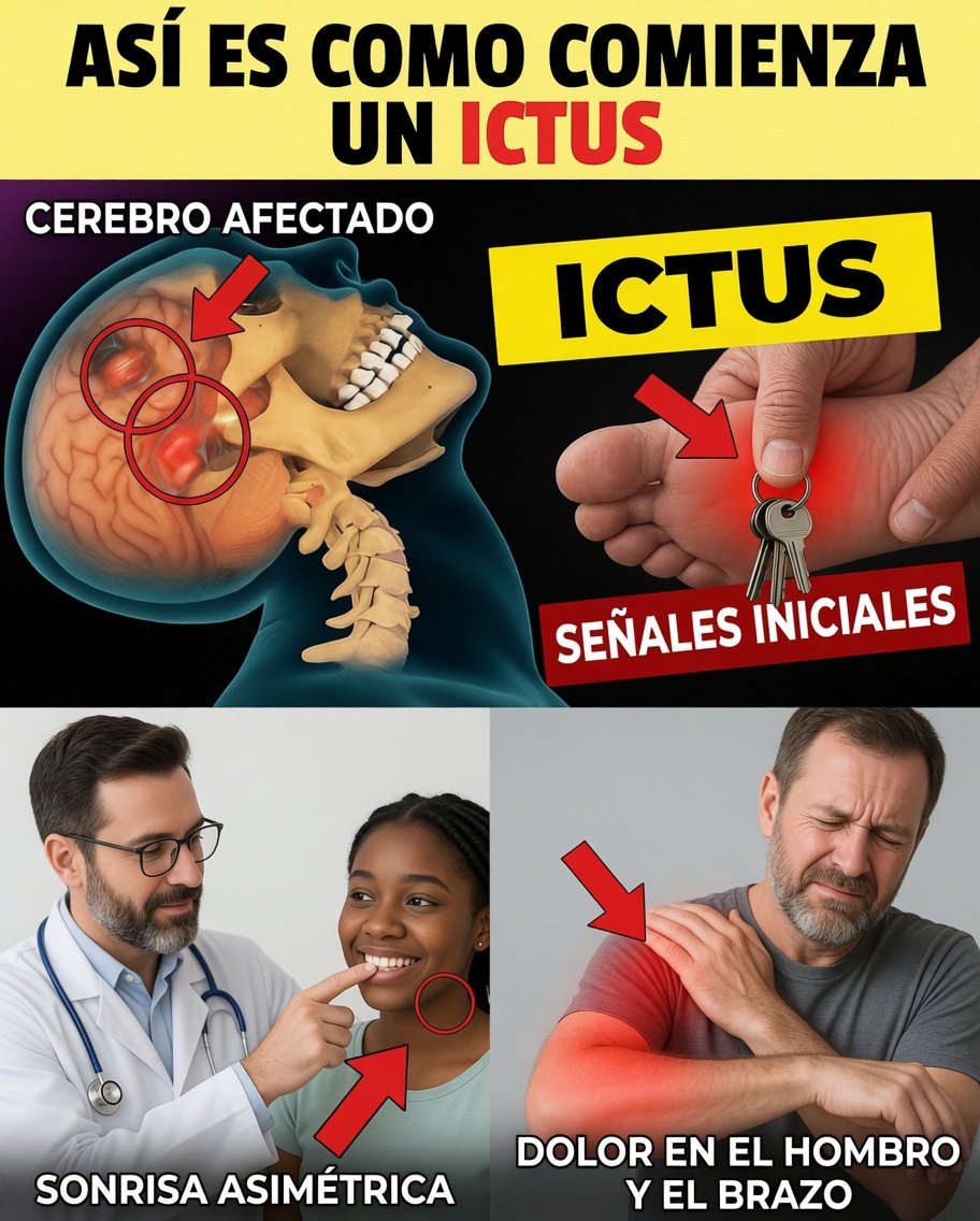 8 Señales de Alerta de un ACV que Puedes Notar Antes de que Sea Demasiado Tarde