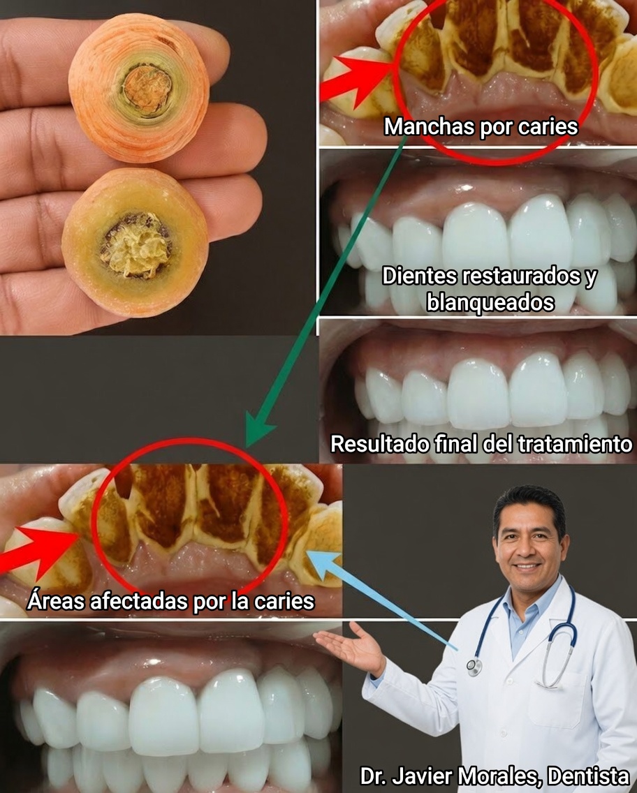 Fortalece tu sonrisa de forma natural: poderosos secretos para proteger tus dientes y encías
