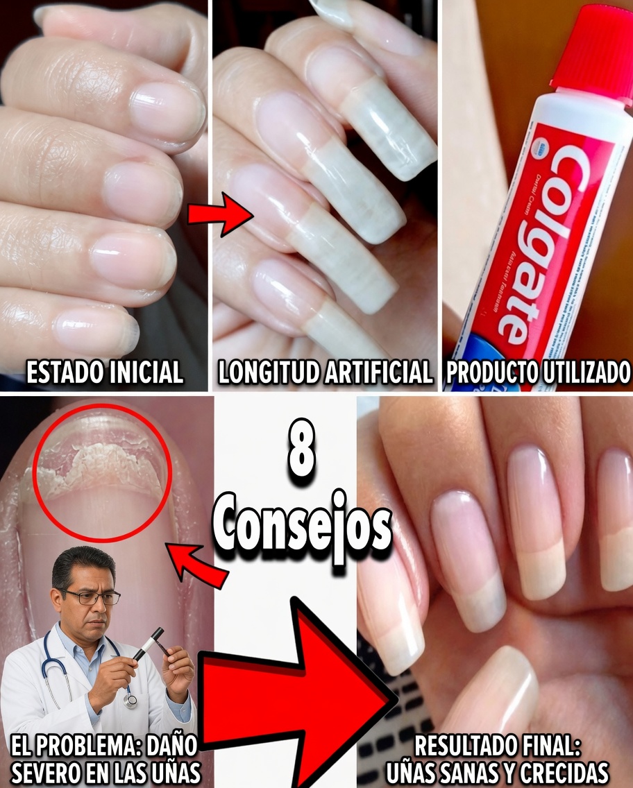Revive las uñas débiles de forma natural: el poderoso secreto del ajo para unas uñas más fuertes y saludables