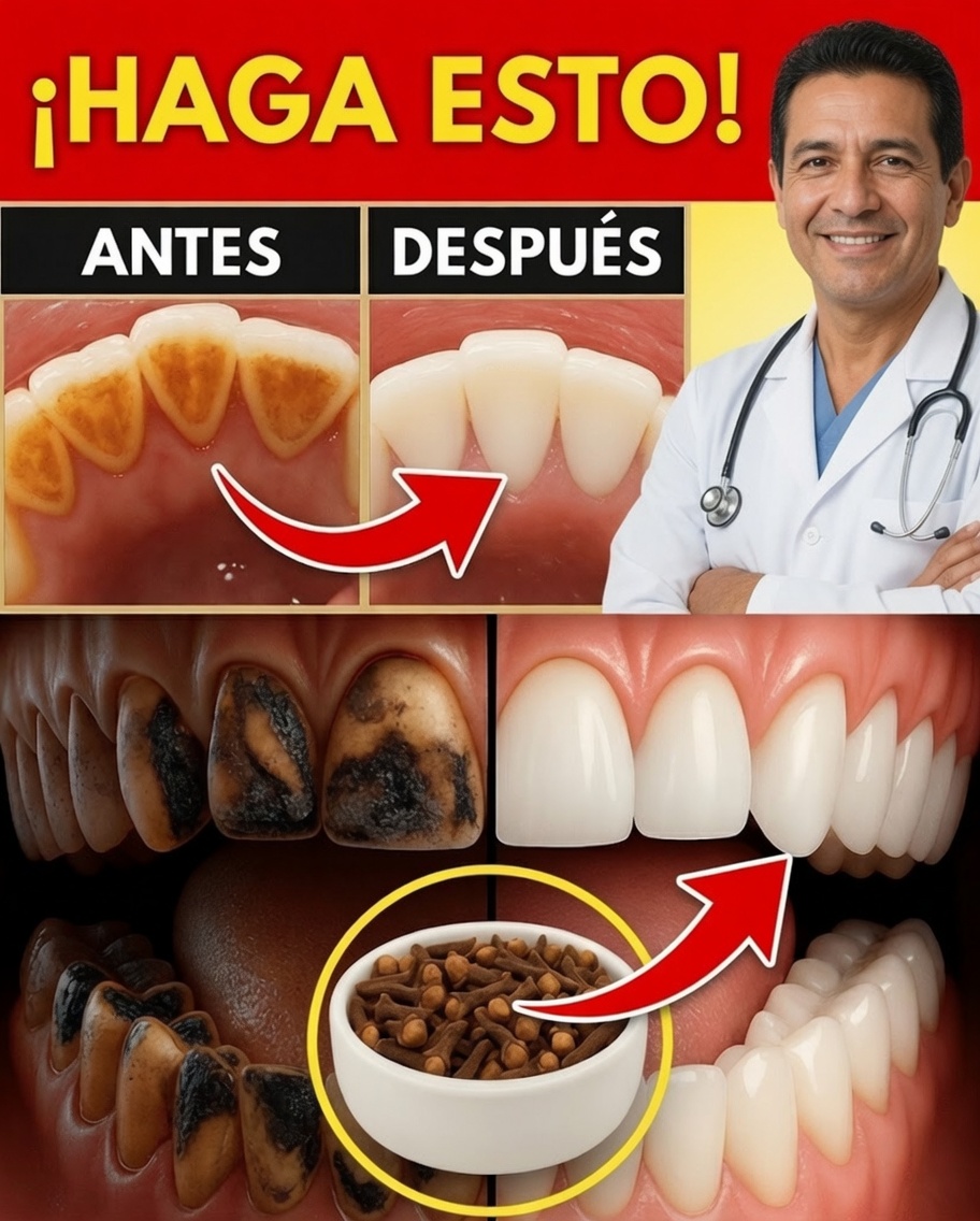 9 Remedios caseros comprobados para eliminar la placa y el sarro de forma natural