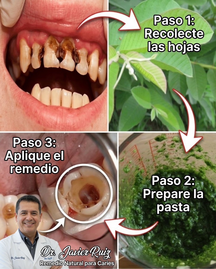 Hojas de guayaba para una sonrisa radiante: el secreto natural del cuidado bucal transmitido por una abuela de 70 años