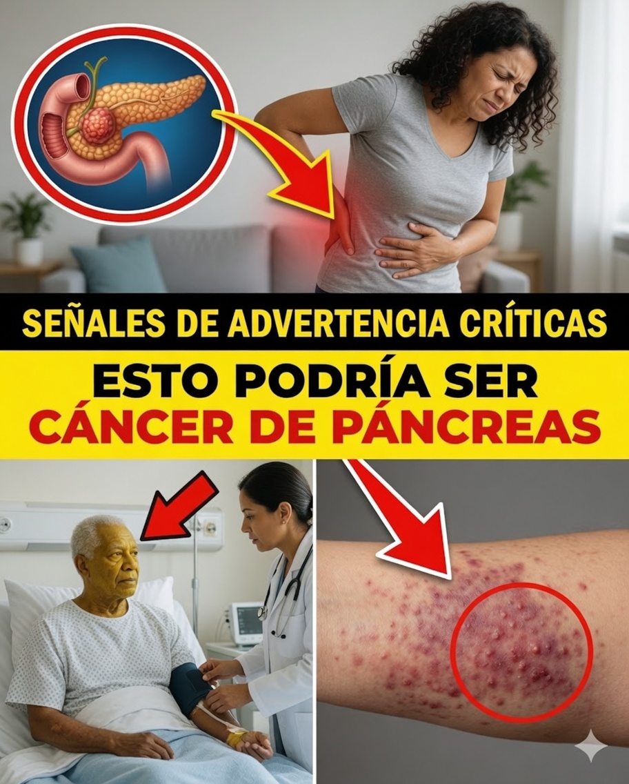 10 señales de alerta ocultas del cáncer de páncreas que probablemente estás ignorando
