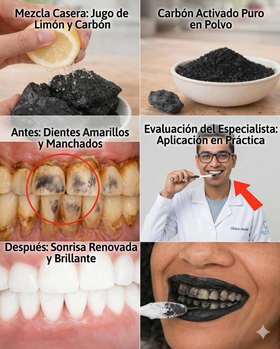 Cómo aclarar los dientes con seguridad: la verdad sobre el carbón y el limón (y lo que realmente funciona)